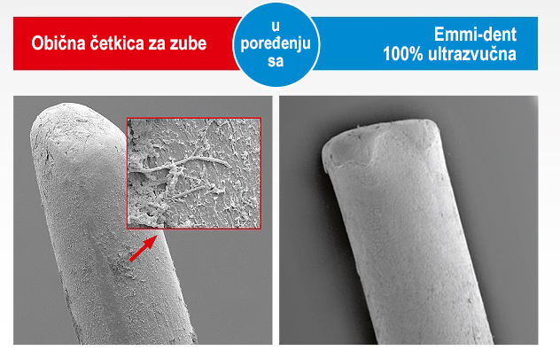 Poređenje čekinje obična četkice za zube i Emmident pod mikroskopom