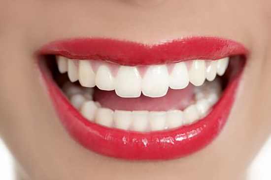 Emmi-dent - nema boljeg rešenja za uklanjanje mrlja sa zuba i obojenosti zuba